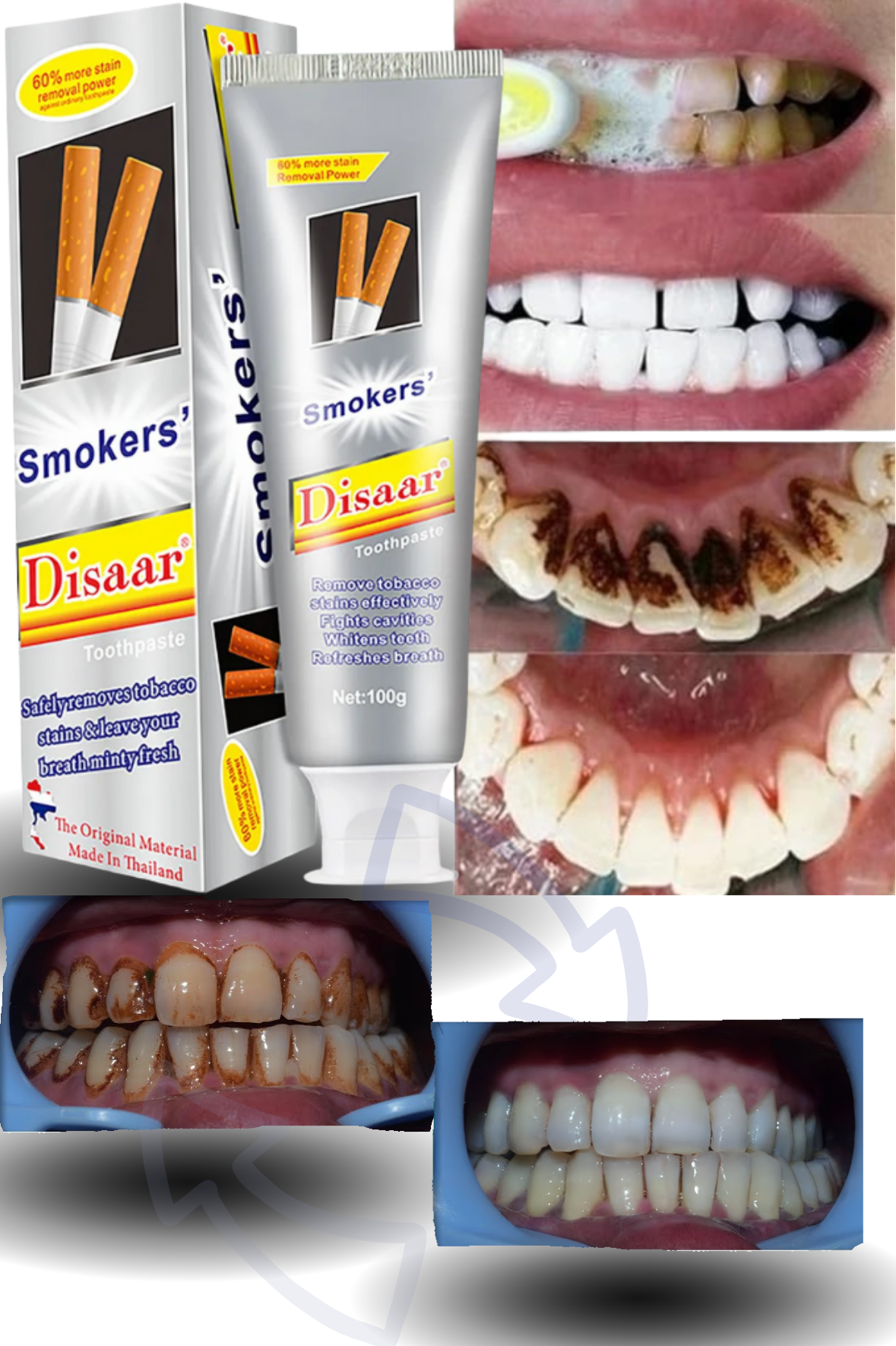 Blanqueador Dental Smoker&rsquo;s Disaar